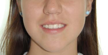 Casos: Ortodoncial Casos: Ortodoncial